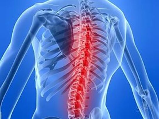doença na coluna causa dor nas costas