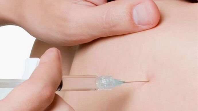 farmacopuntura para osteocondrose mamária