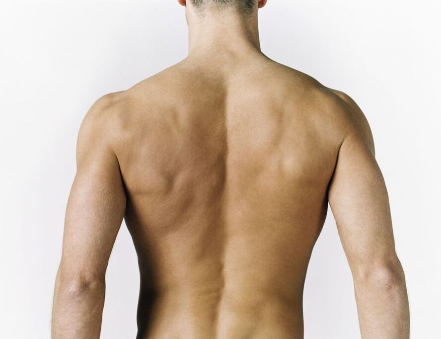 inflamação dos músculos das costas como causa de dor entre as omoplatas