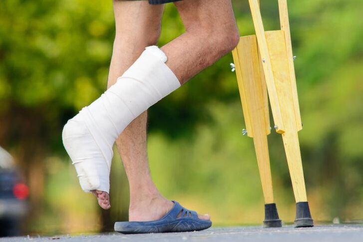 lesão no tornozelo como causa de artrose